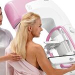 Mammográfiás szűrővizsgálat: indulási időpontok