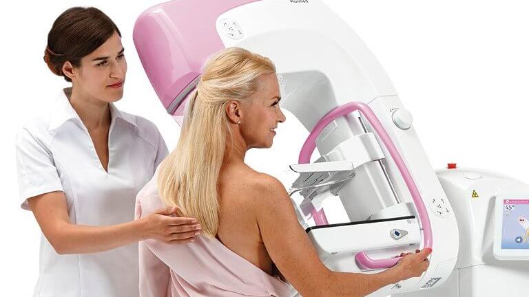 Mammográfiás szűrővizsgálat: indulási időpontok